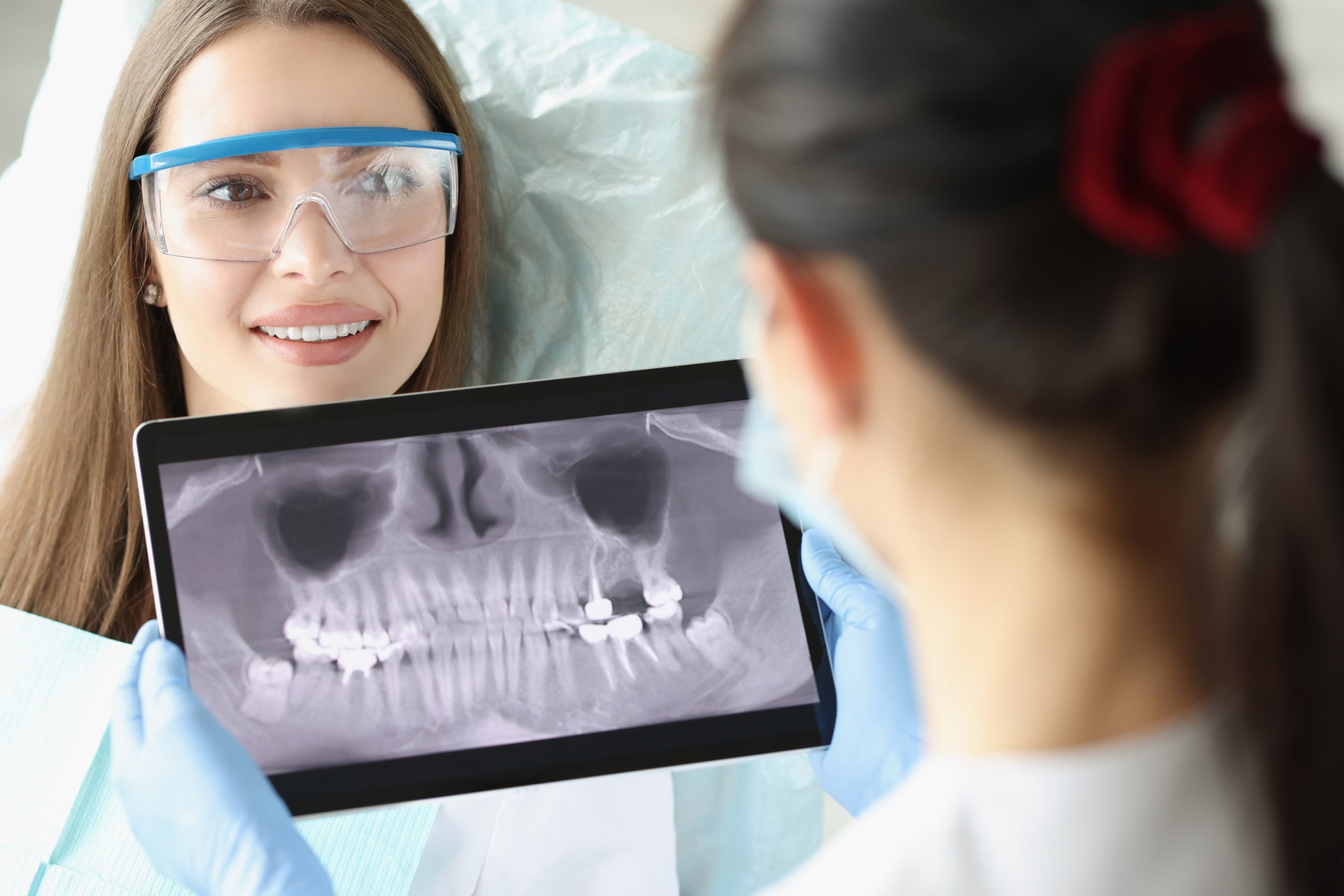 Are Dental X-Rays Safe? Dentist in Framingham Answers